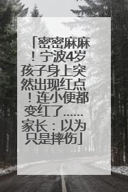 密密麻麻！宁波4岁孩子身上突然出现红点！连小便都变红了……家长：以为只是摔伤